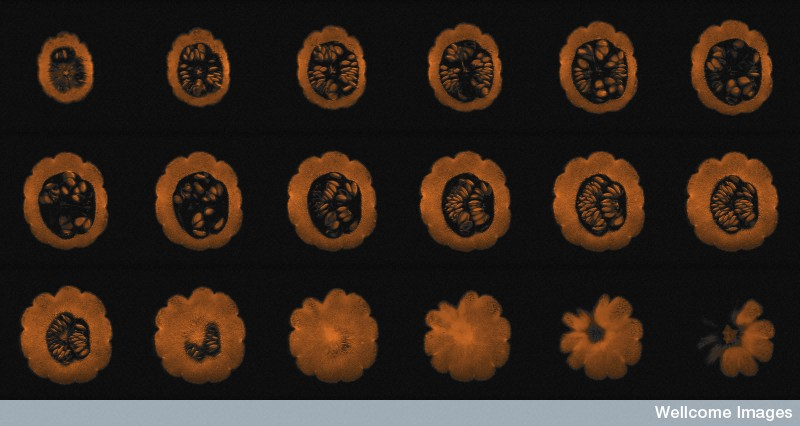 Illustration for article titled This Is How Your Fruits and Vegetables Look in an MRI Machine